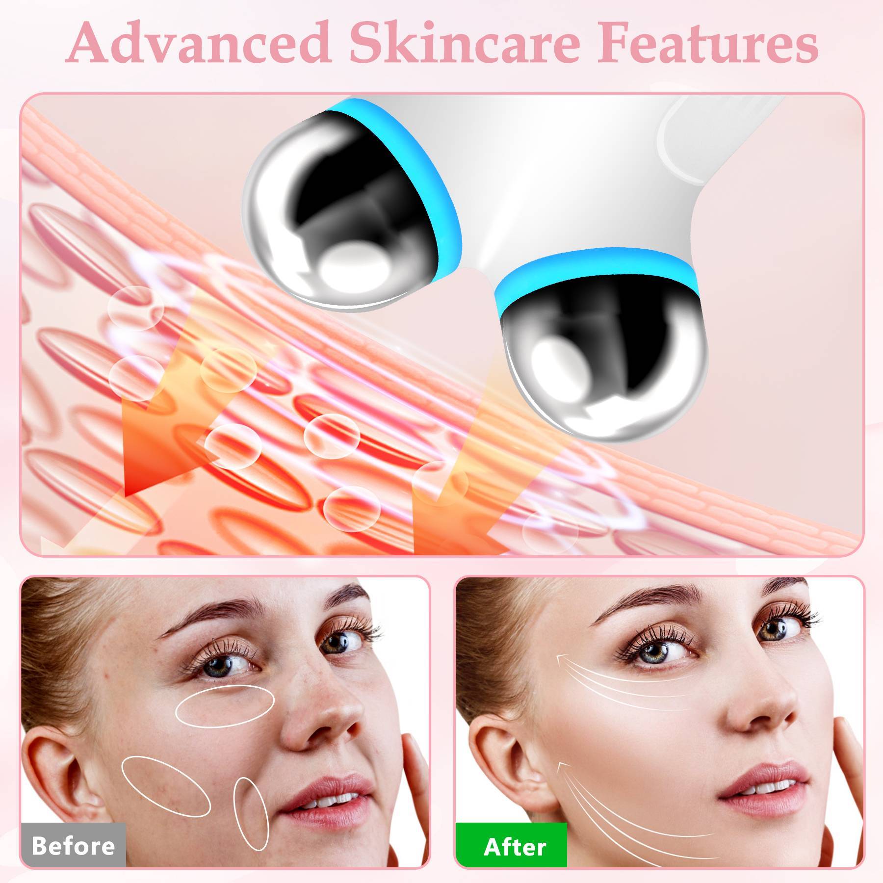SkinHaven NeoGlow Device - myrelevo