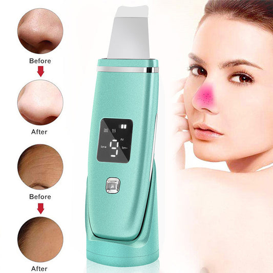 PureSonic™ Ultrasonic Blackhead & Skin Lifting Device